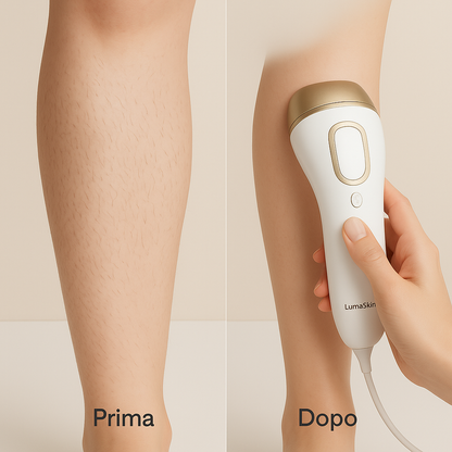 LumaSkin Pro 5 – Epilatore Laser IPL a Luce Pulsata